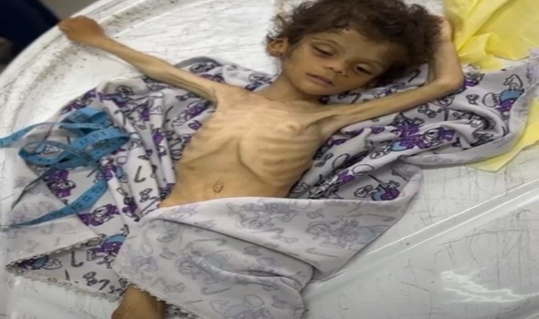  لبنان اليوم - الذكاء الإصطناعي يخطأ بإتهام نائب فرنسي إستخدام صورة غير صحيحة للمجاعة في غزّة